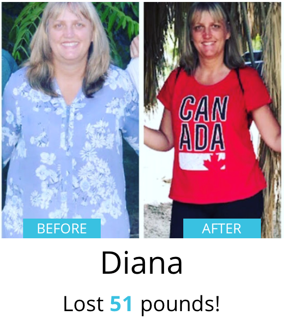 Diana Before & After| Shulman Weightloss