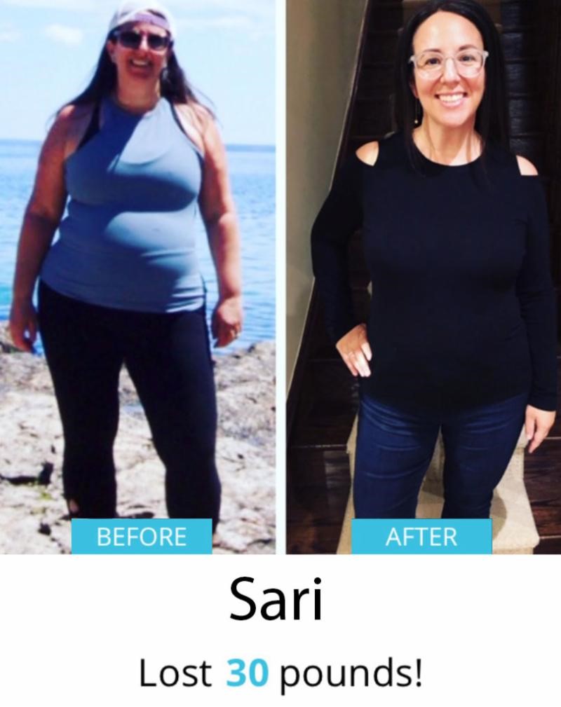 Sari Before & After | Shulman Weightloss