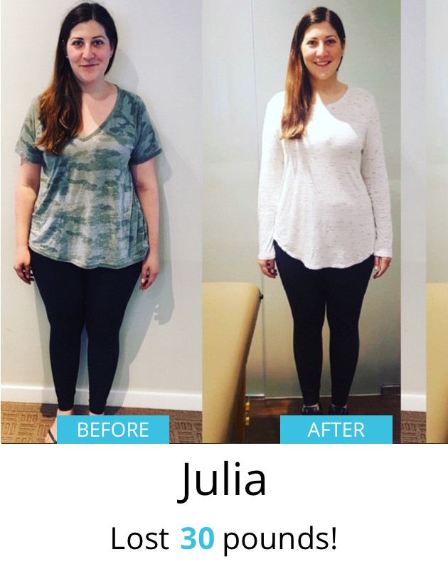 Julia Before & After | Shulman Weightloss