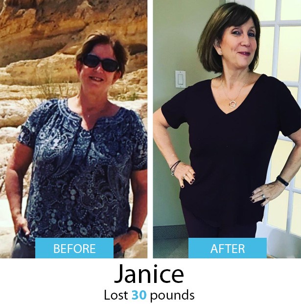 Janice Before & After | Dr. Joey Shulman Weightloss Clinic